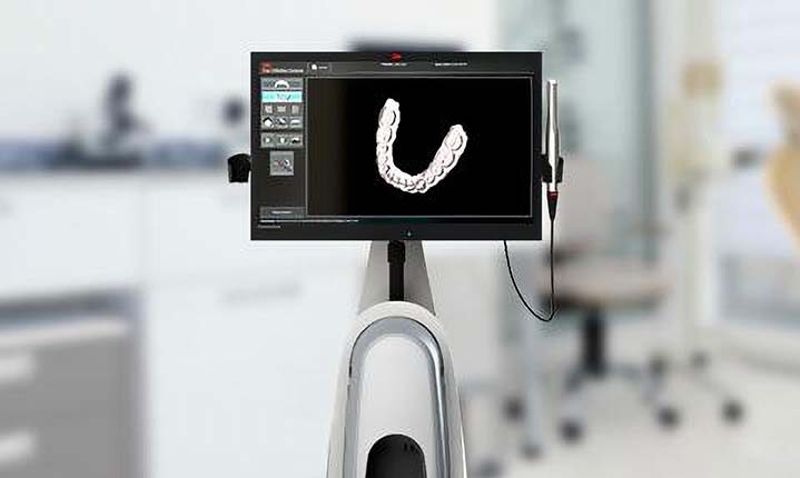 3D True Definition Digital Scanner - Creating Smiles Dental - Clearwater & St. Petersburg FL